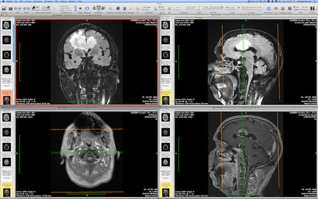 open-ct-files