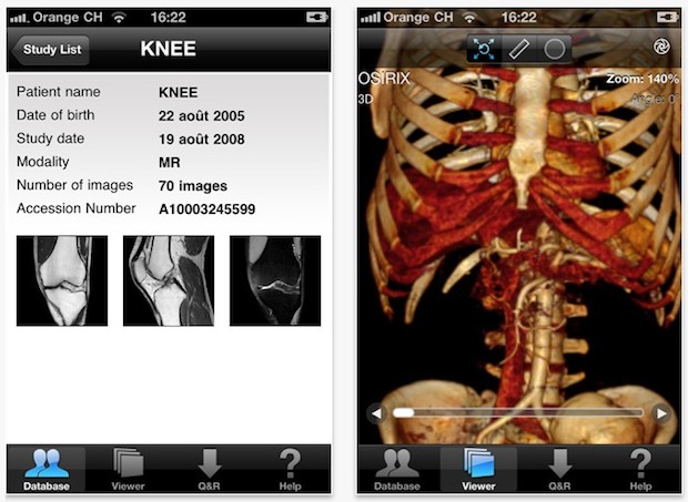 Photo Management Software Overview300 _MicroDicom - Free DICOM viewer ...