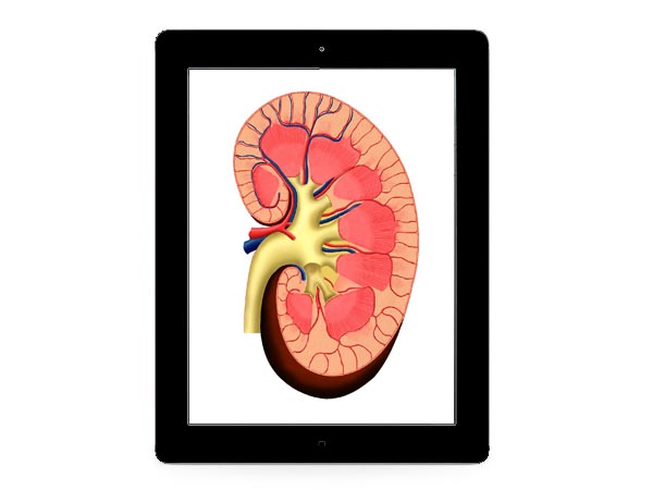 Kidney sold to buy iPad 2 Kidney iPad 2